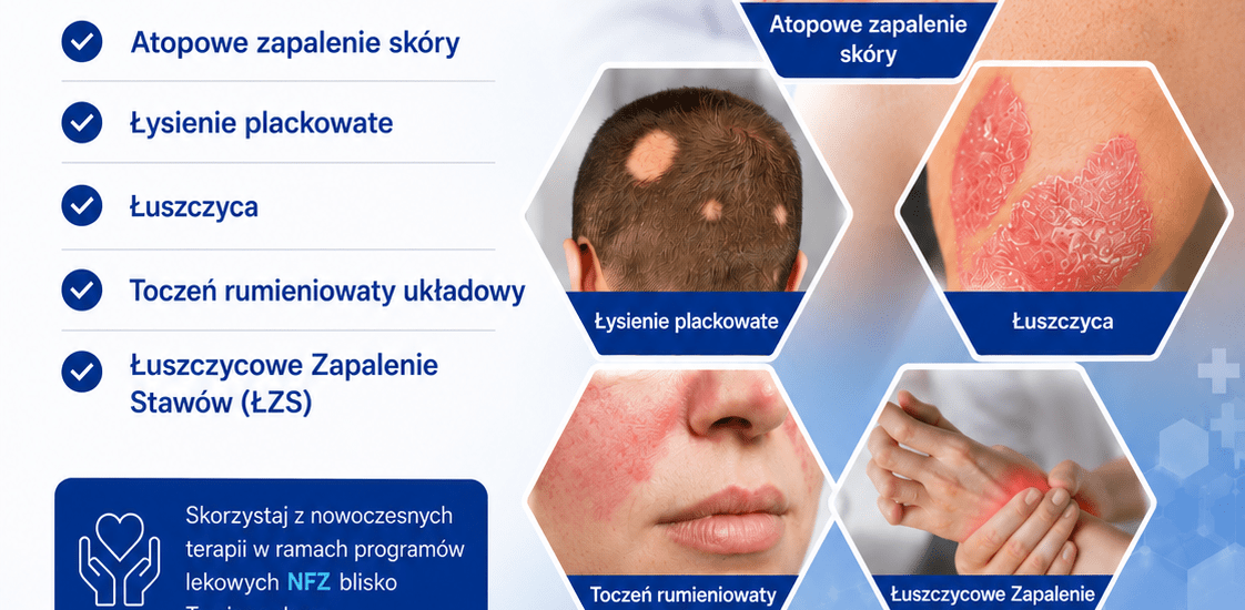 Nowoczesne leczenie chorób skóry dostępne w Stalowej Woli